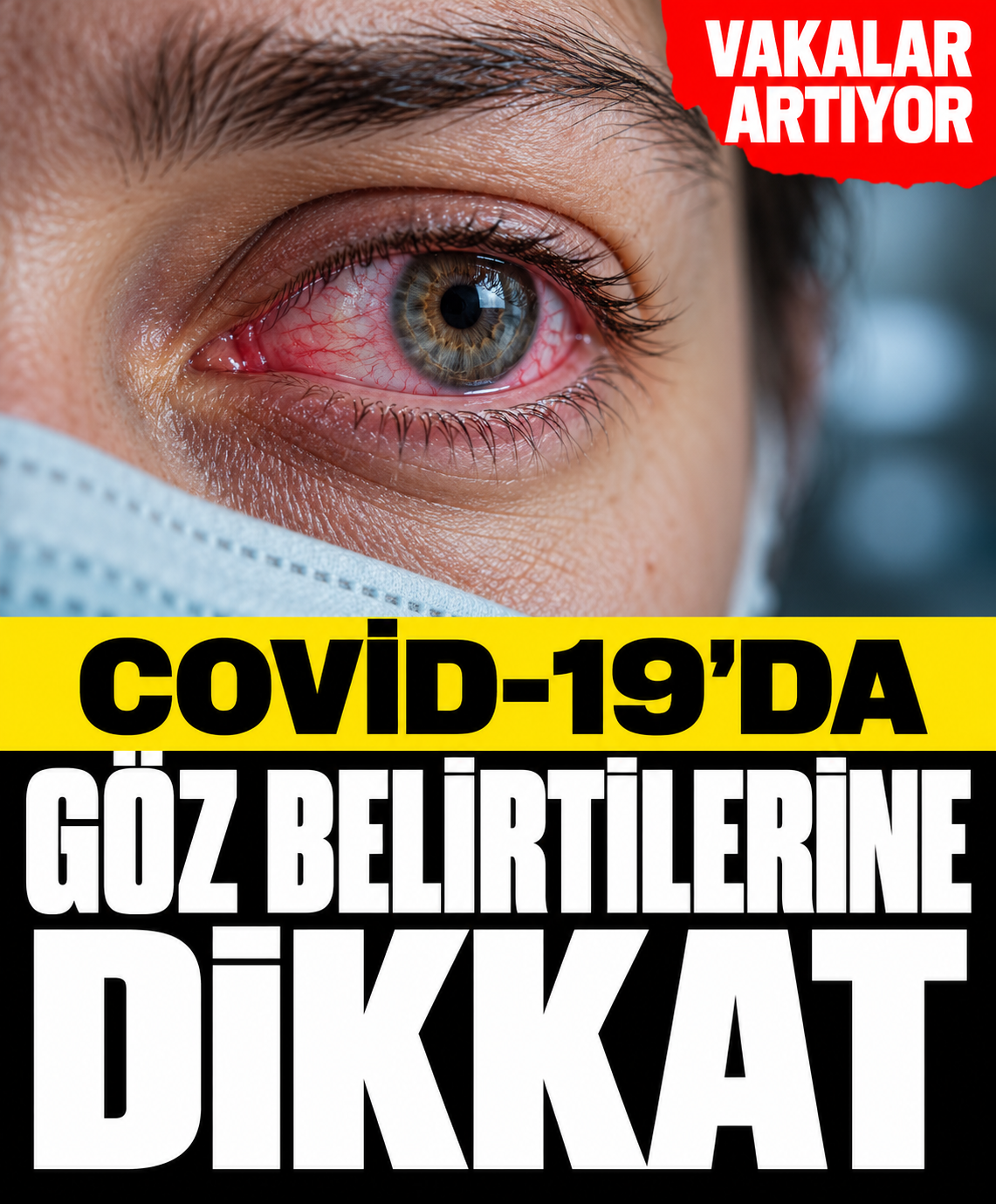 Vakalar Artıyor, Göz Belirtilerine Dikkat